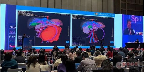 青大附院院長董蒨 海信CAS賦能醫學三維分析，躋身世界最高醫學科技舞臺